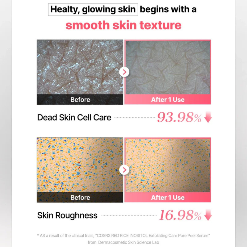 COSRX Red Rice Inositol Exfoliating Care Pore Peel Serum