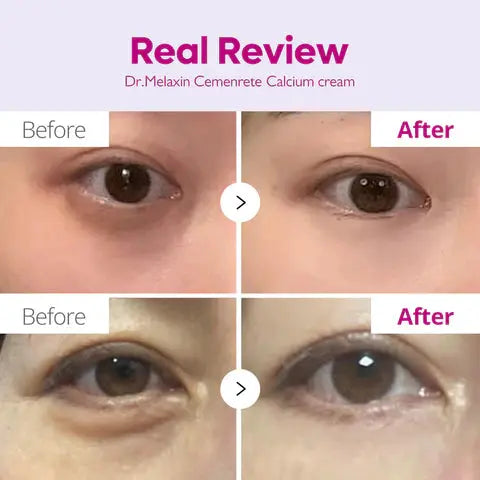 Dr. Melaxin Cemenrete Calcium Intense Cream