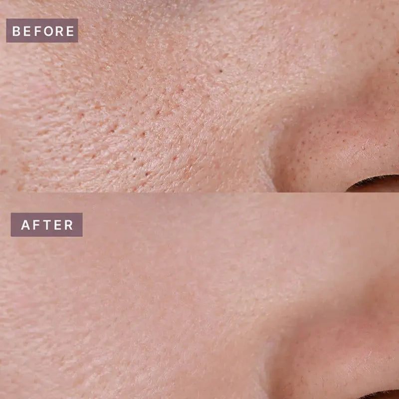 Heveblue Pot Pore Tightening Podo Ampoule