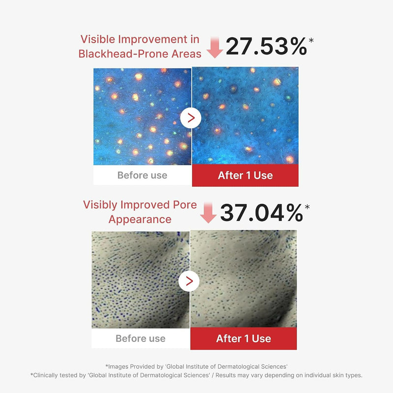 Medicube Hypochlorous Acid Peel Mask, zuiverend en hydraterend sheet mask