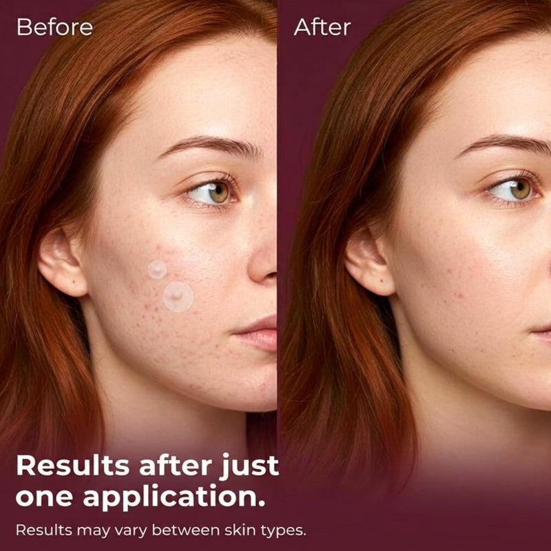 Patches and Pads Pimple Patches Spotlight