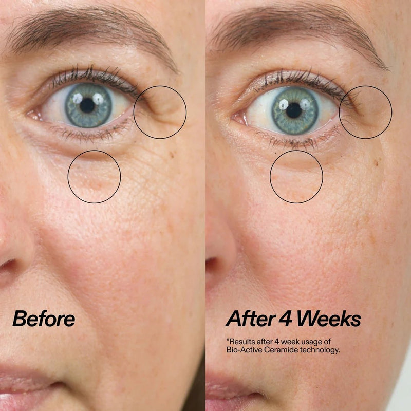 The Inkey List Bio-active Ceramide Eye Cream, oogcrème die fijne lijntjes verzacht en hydrateert