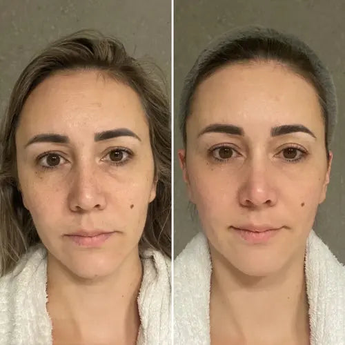 Bbody Collagen Tripeptide & Vitamine C