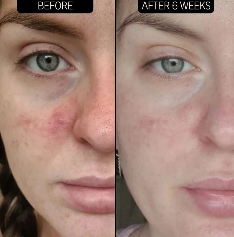 The Inkey List SuperSolutions Redness Relief Solution