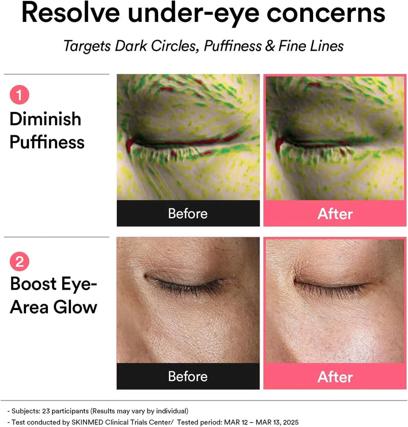 Abib PDRN Retinal Eye Patch Glow Jelly