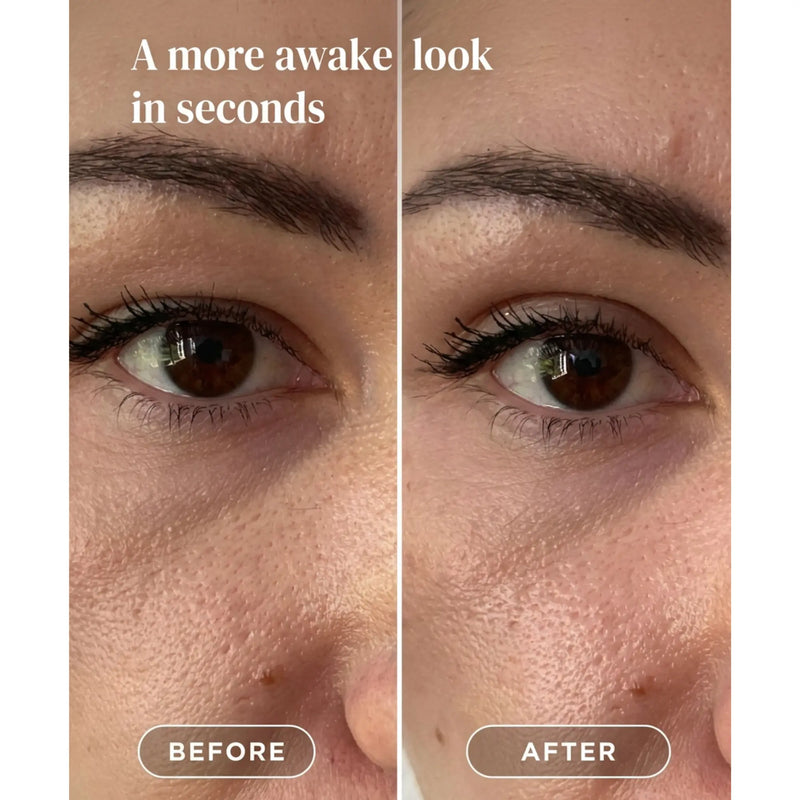 Apricot Beauty Eyelid Lifting Tapes