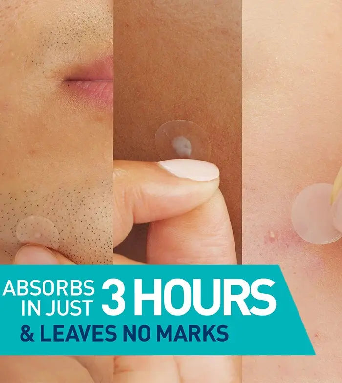 CeraVe Anti-Blemish Patches