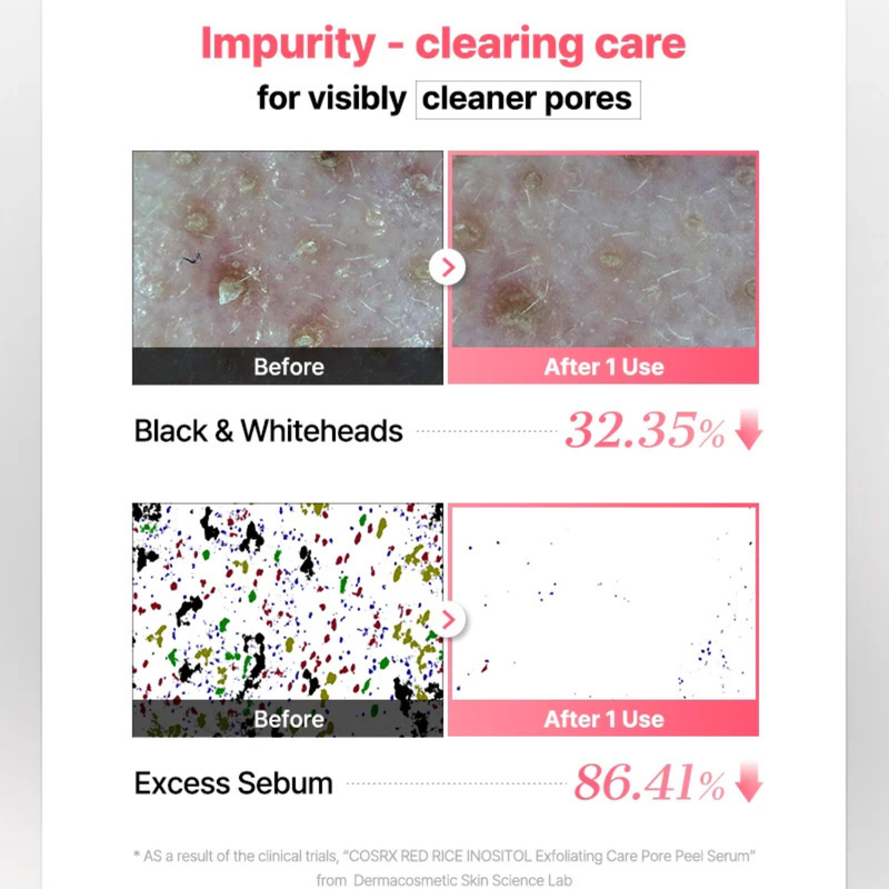 COSRX Red Rice Inositol Exfoliating Care Pore Peel Serum