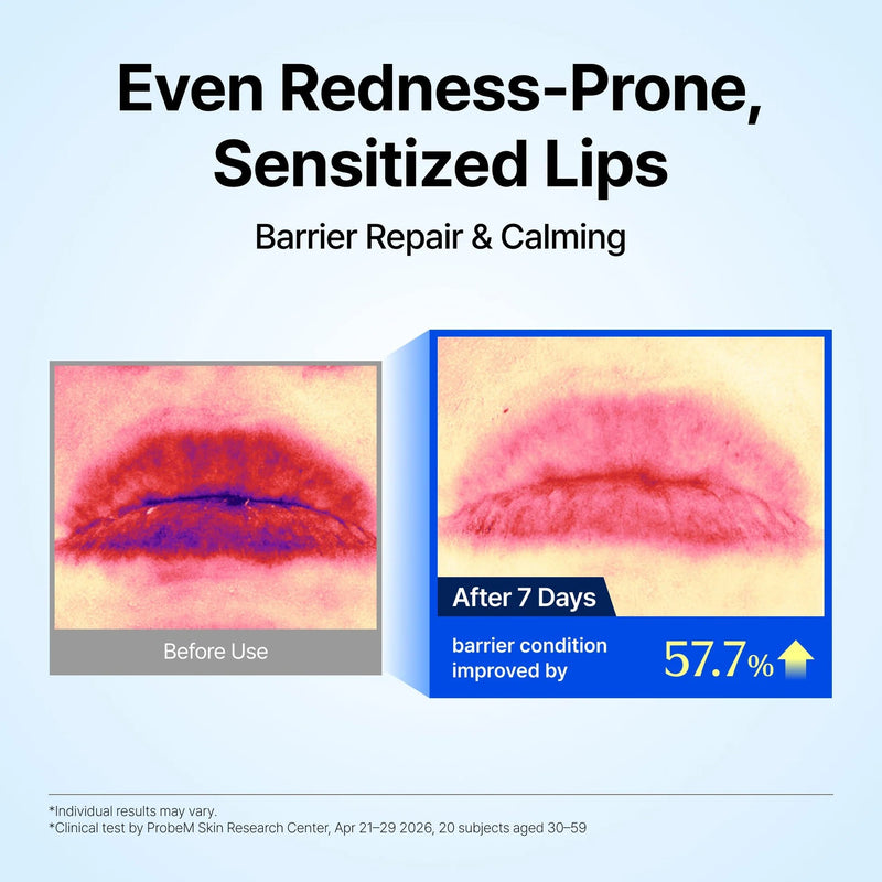 Klairs Blue EGF Barrier Lip Balm, lippenbalsem die de lipbarrière herstelt