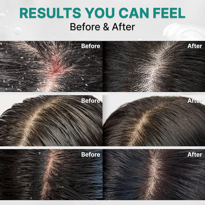Lilyeve Scalp Turn Cica PDRN Deep Clean Shampoo