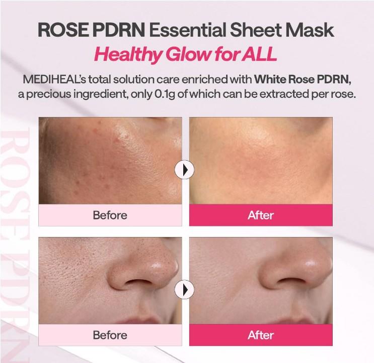 Mediheal Rose PDRN Essential Mask Healthy Glow