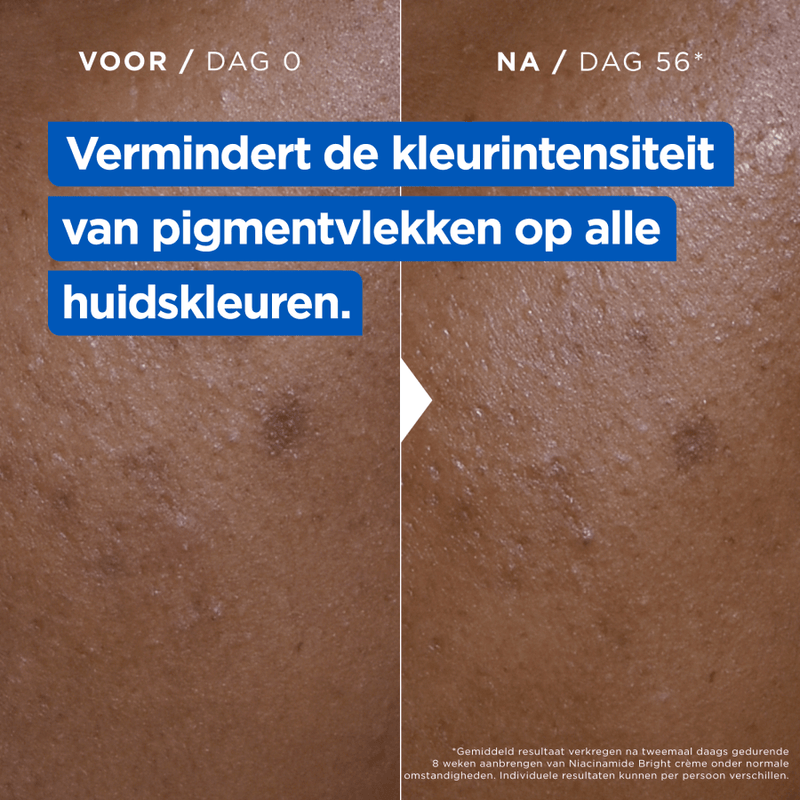 Mixa Niacinamide Bright Moisturizing Cream