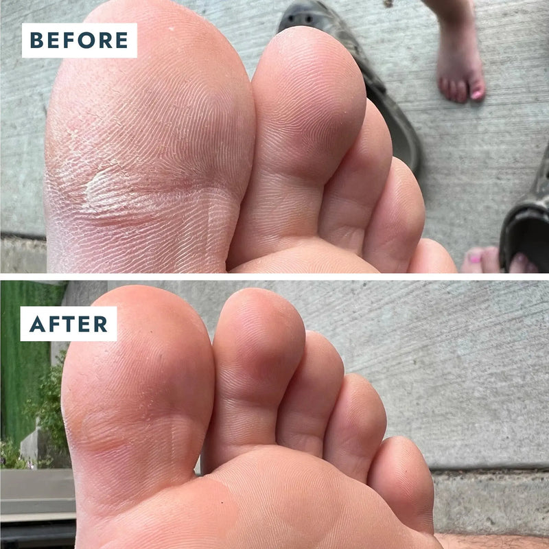 Voesh SoleMate Heel Repair Balm