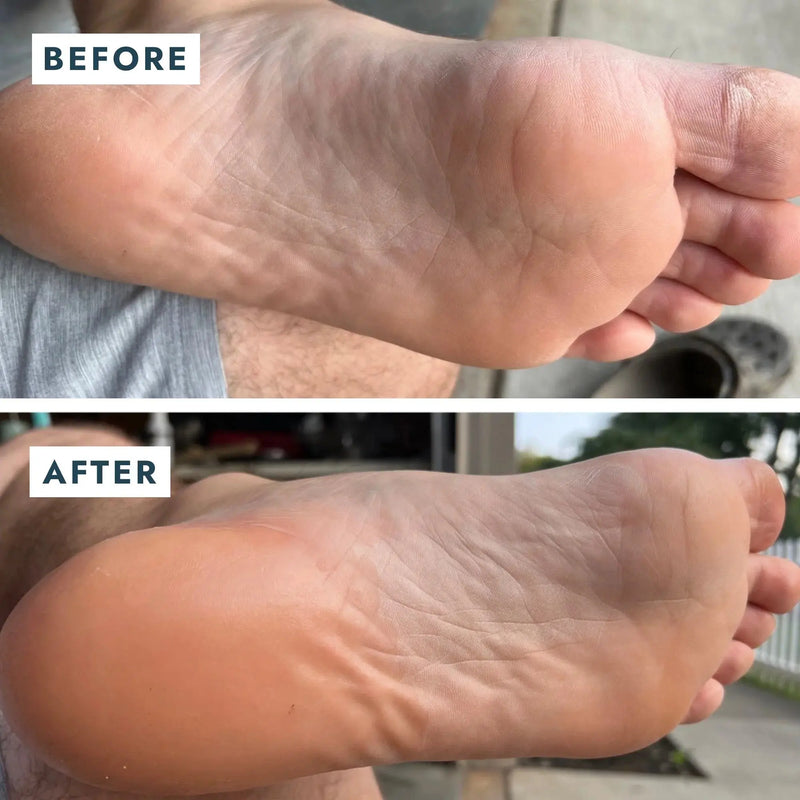 Voesh SoleMate Heel Repair Balm